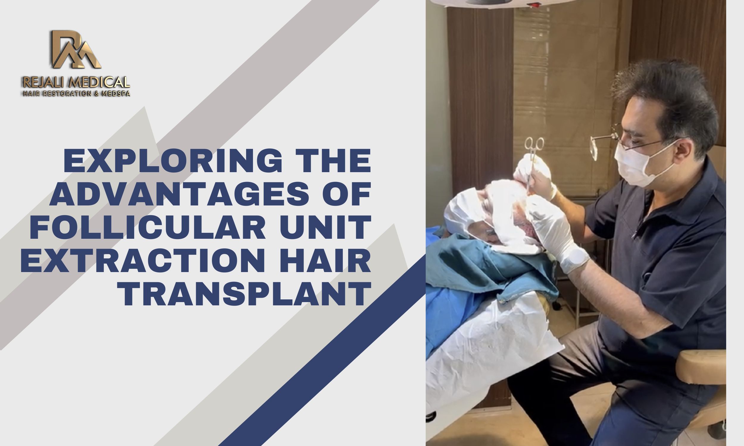 Exploring the Advantages of Follicular Unit Extraction Hair Transplant