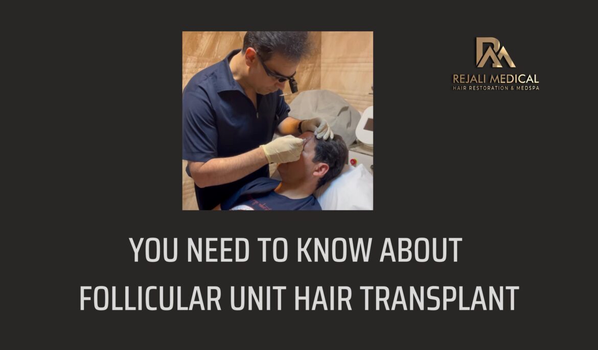 You Need to Know About Follicular Unit Hair Transplant