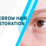EYEBROW HAIR RESTORATION