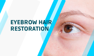 EYEBROW HAIR RESTORATION