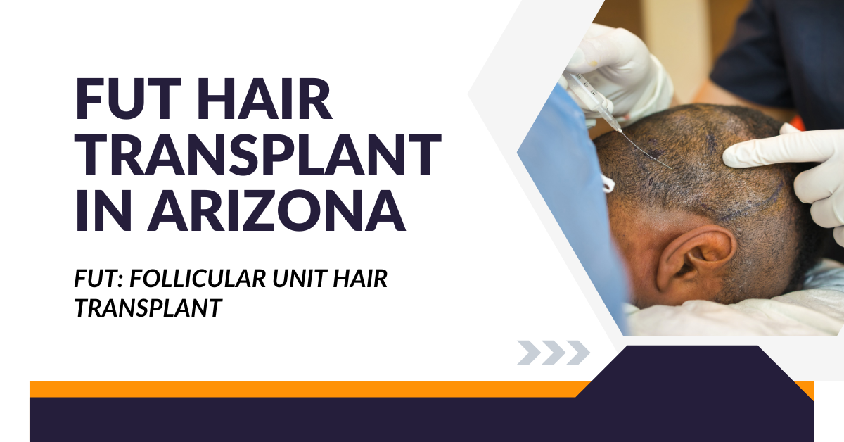 FUT Hair Transplant in Arizona