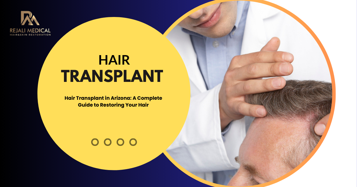 Ariozna Hair Transplant