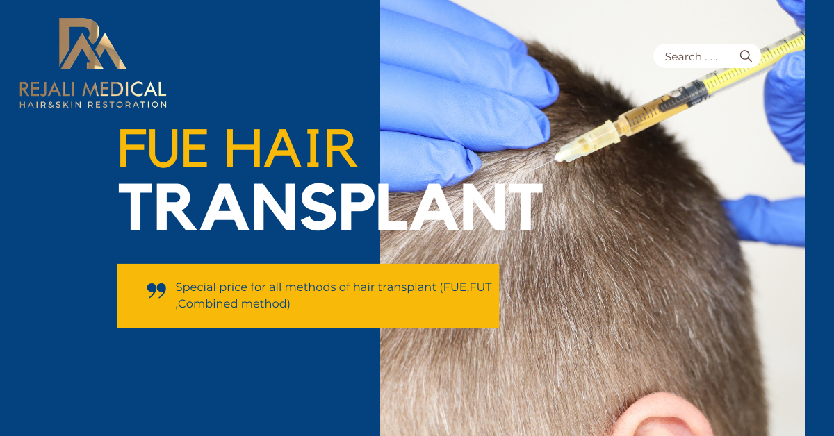 Hair Transplant
