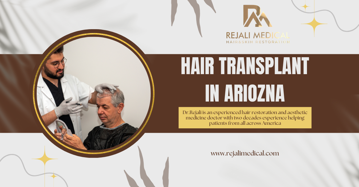 Hair Transplant in Ariozna