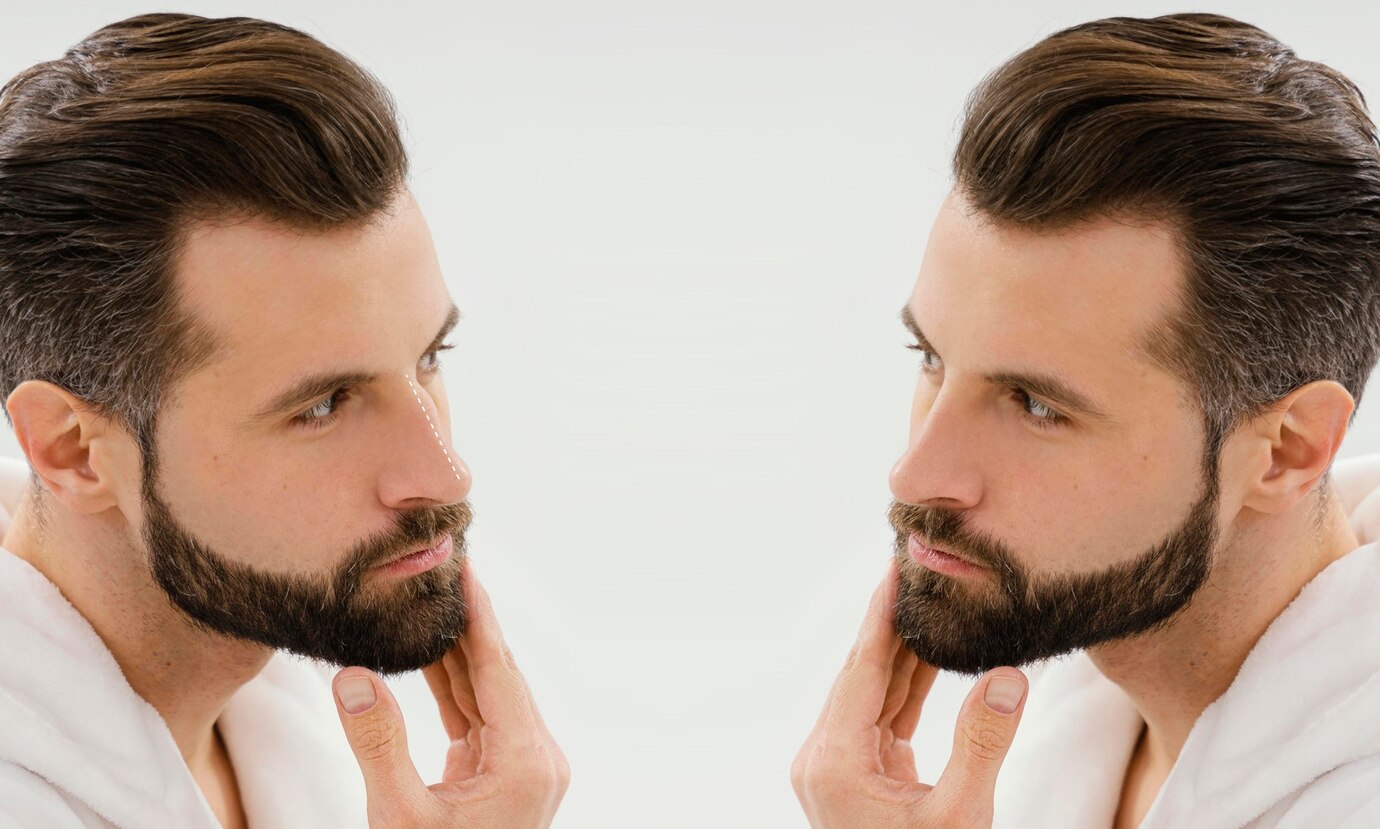 Beard Hair Transplant