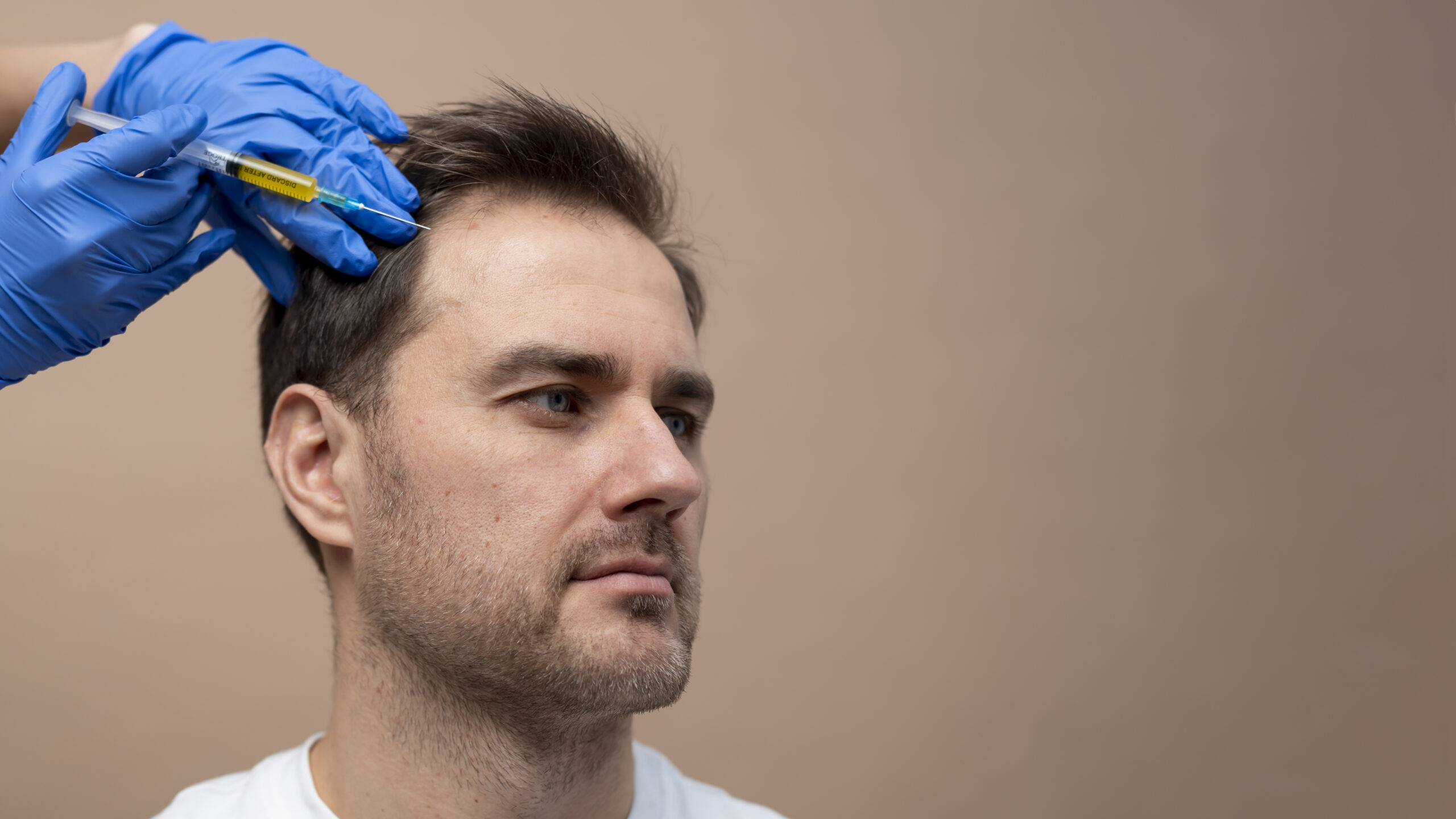hair transplant