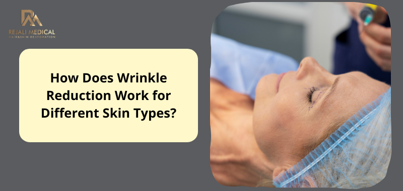 How-Does-Wrinkle-Reduction-Work-for-Different-Skin-Types.