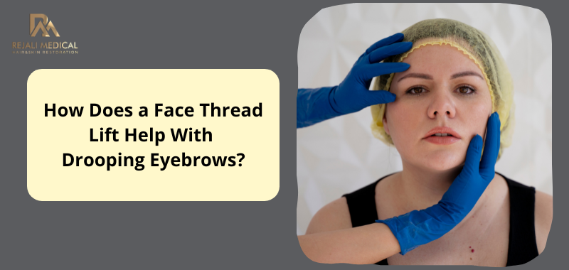 How-Does-a-Face-Thread-Lift-Help-With-Drooping-Eyebrows