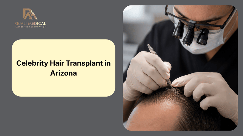 Celebrity Hair Transplant in Arizona