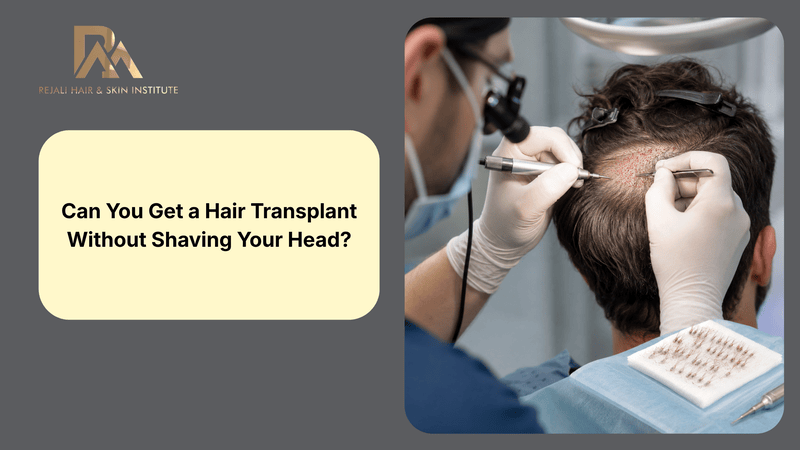 Can You Get a Hair Transplant Without Shaving Your Head