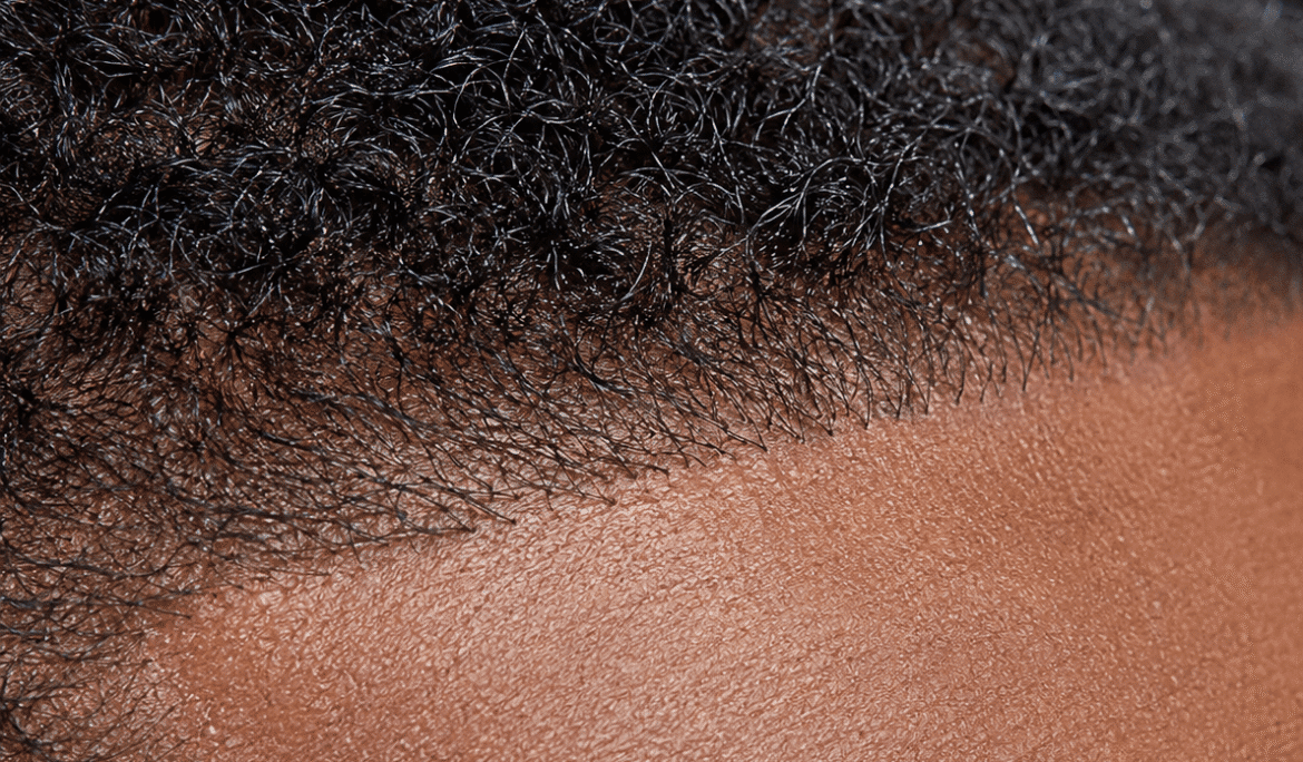 Close-up of dark, curly hair at the hairline of a person.
