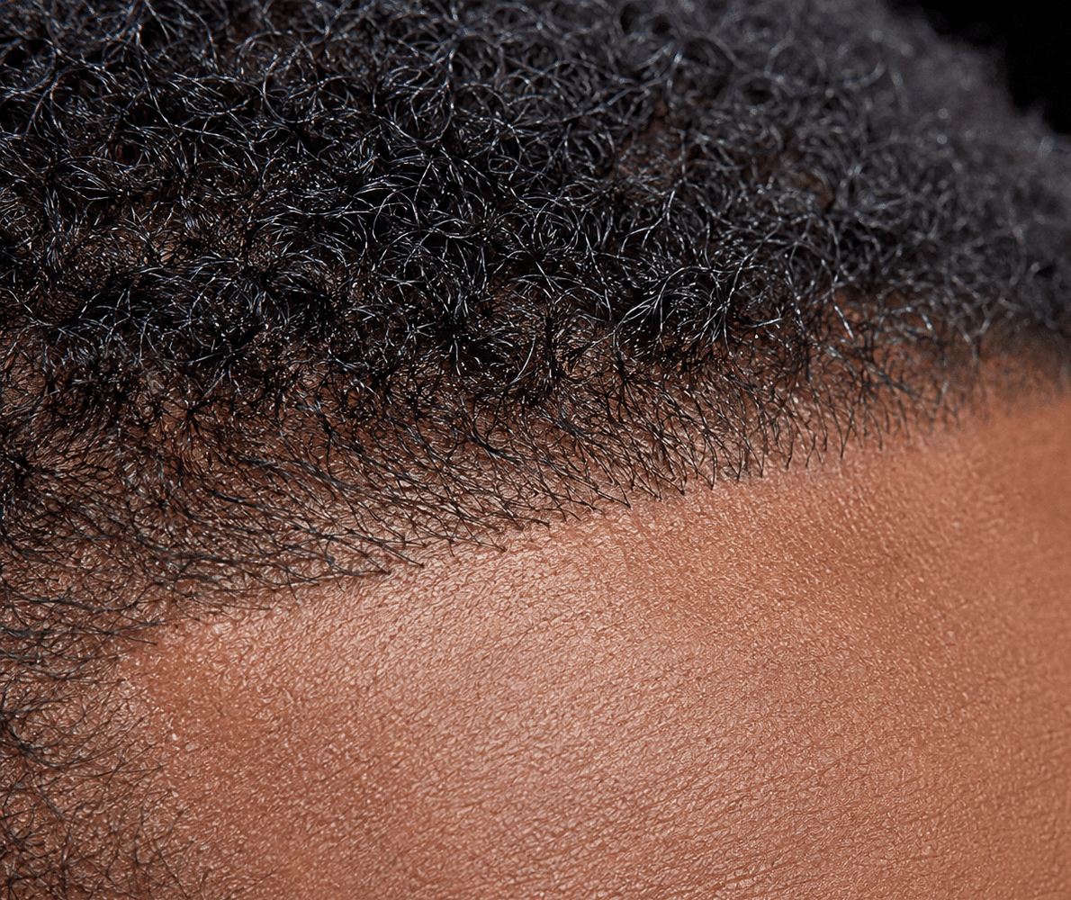 Close-up of dark, curly hair at the hairline of a person.
