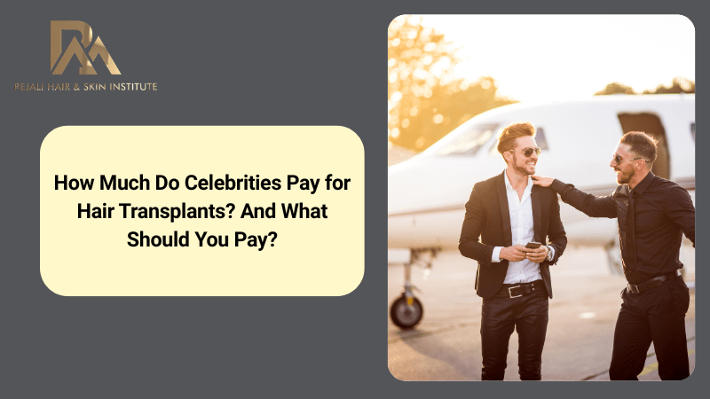 How Much Do Celebrities Pay for Hair Transplants? And What Should You Pay?
