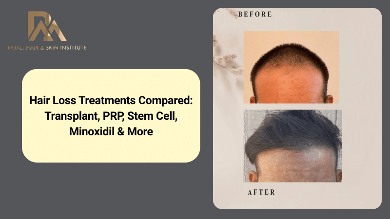 hair loss treatments comparison