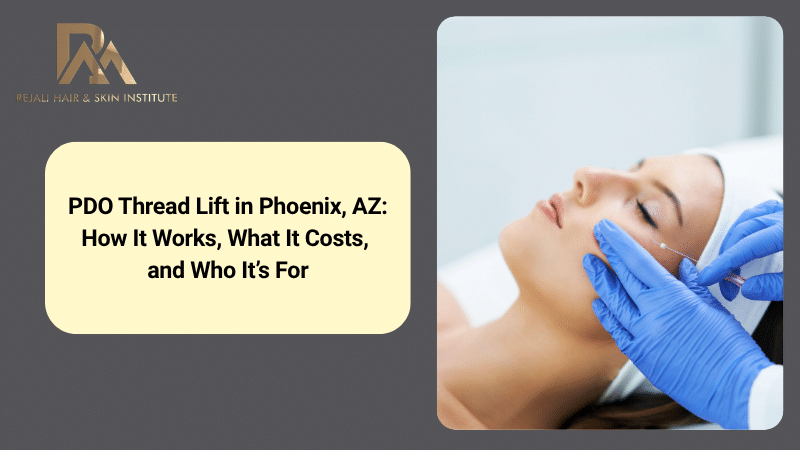 PDO thread lift Phoenix AZ